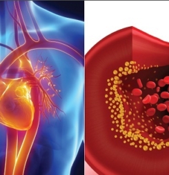 Biện pháp điều trị cao huyết áp tự lá sen